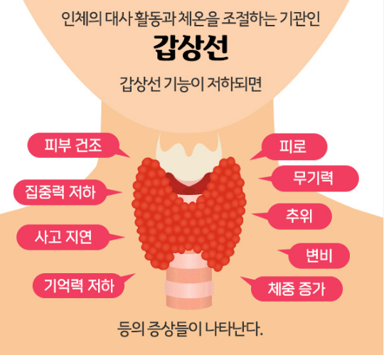 갑상선 기능저하증