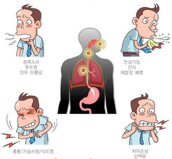 역류성 식도염