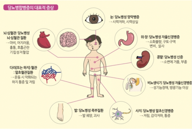 당뇨병